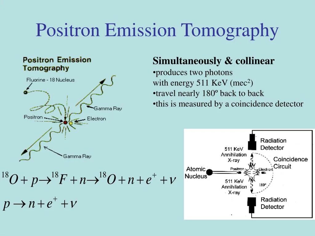 Позитрон личный кабинет. Positron emission. Positron emission tomography. Позитрон СПБ. Positron emission tomography research.