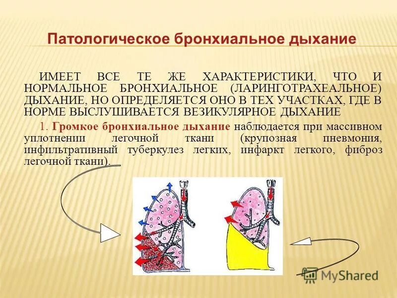 3 везикулярное дыхание