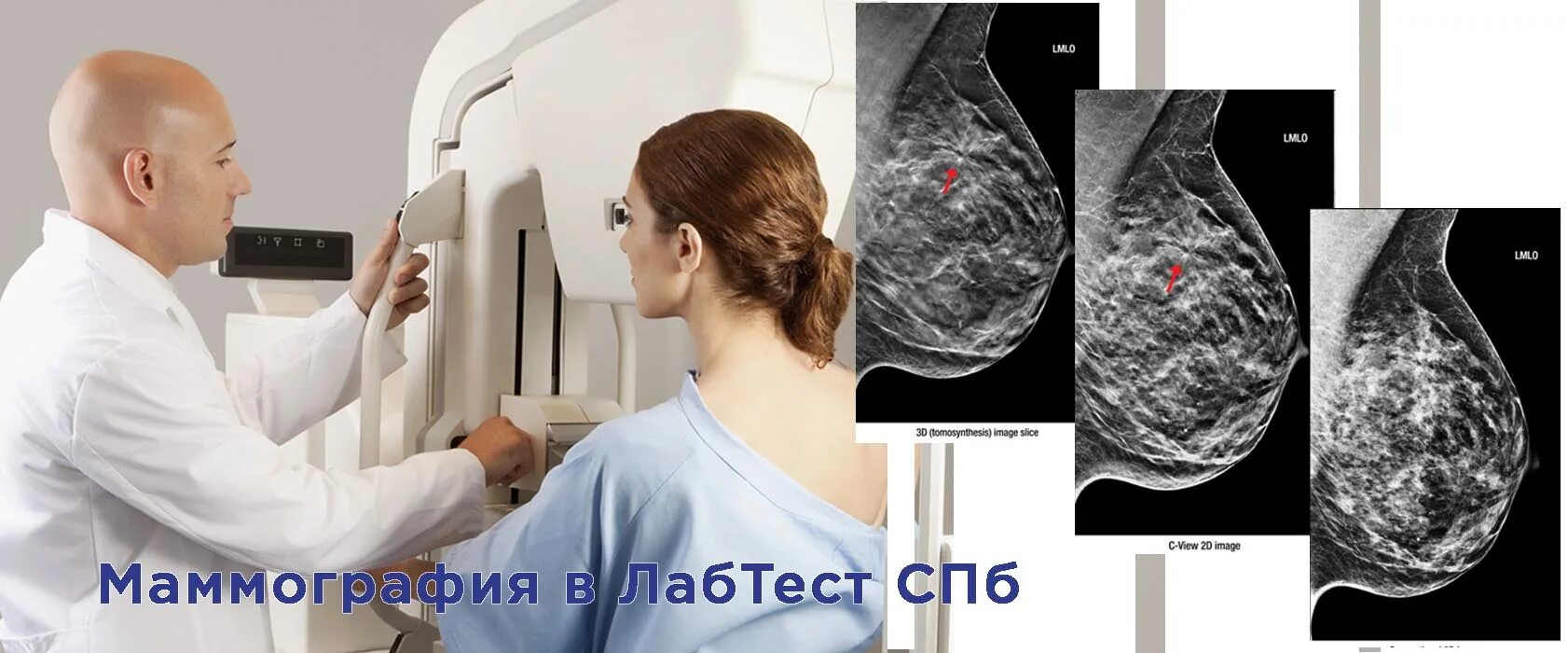 Маммография платно. Маммография на современном оборудовании. Как делают маммографию фото. Платная маммография. Маммография как делается.