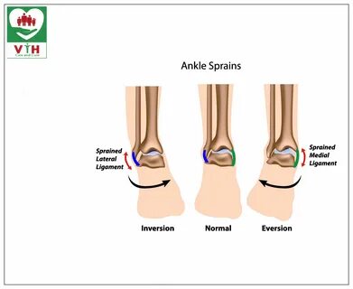 Ankle перевод