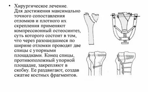 Травматология нижней конечности
