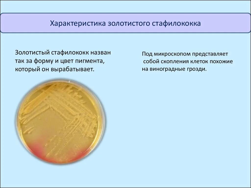 Как вылечить золотистый. Источник золотистого стафилококка. Посев на золотистый стафилококк. Пигментообразование стафилококка.