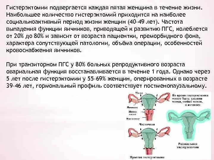 Гистерэктомия отзывы