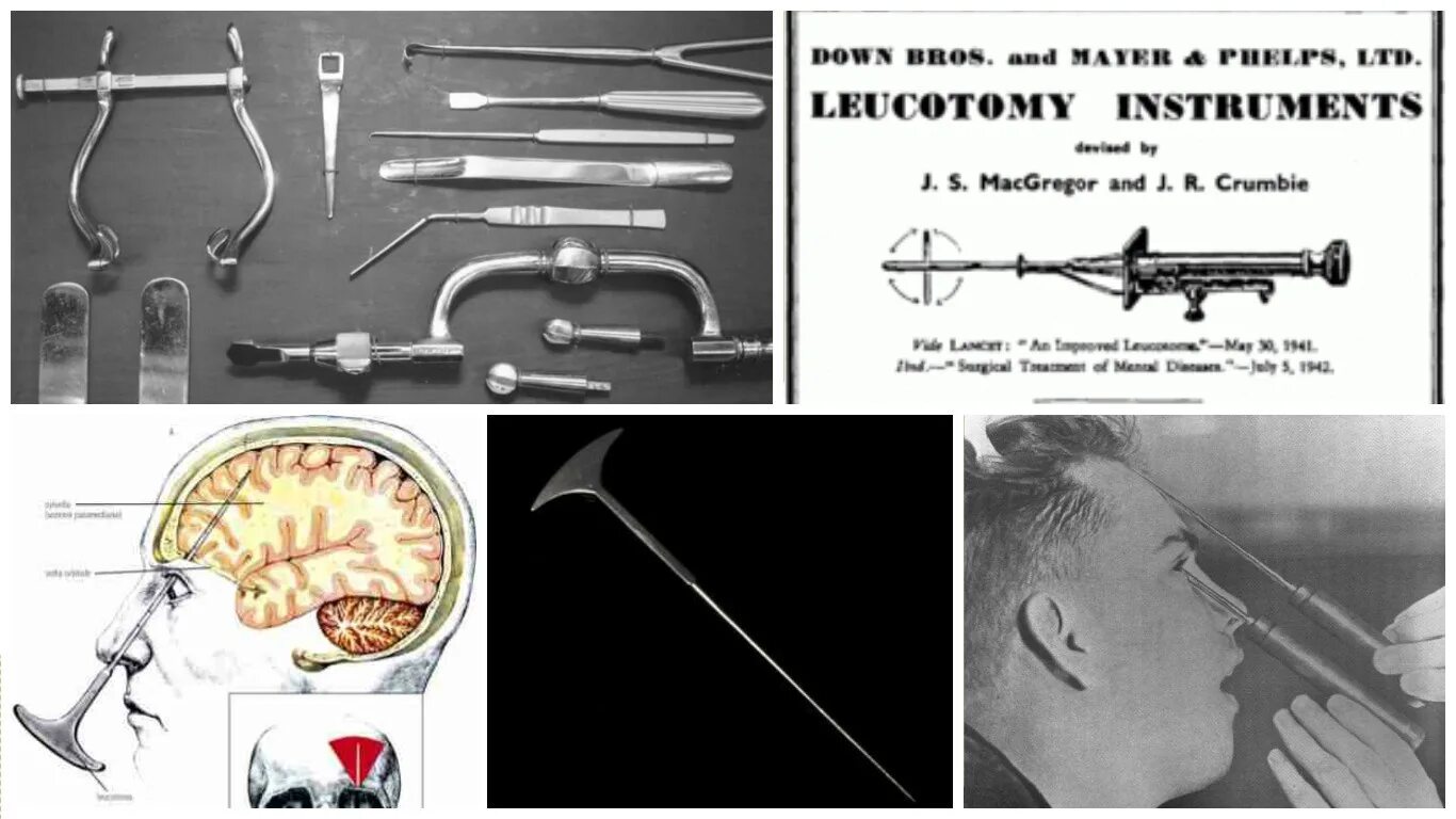 Lobotomy dear. Lobotomy corporation hokma. Лоботомия корпорейшн гебура. Lobotomy dear. Тиферет лоботомия.