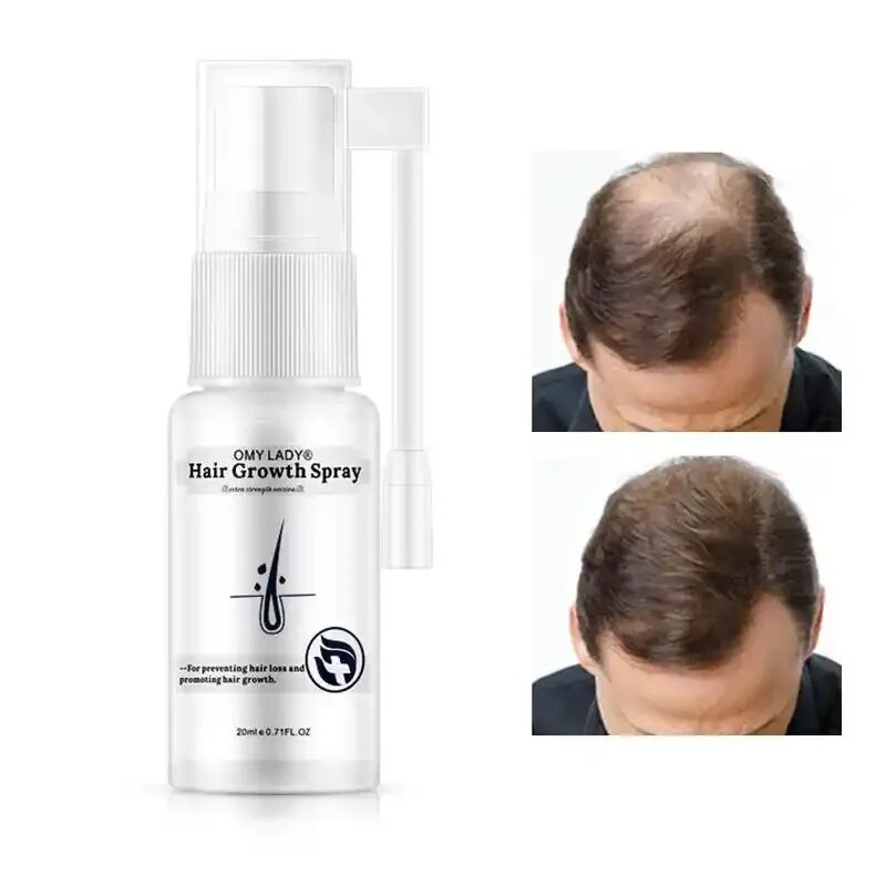 для облысения волос для мужчин средство. средство против облысения для мужчин. эффективное от облысения для мужчин. эффективное от облысения для мужчин. средство от облысения.