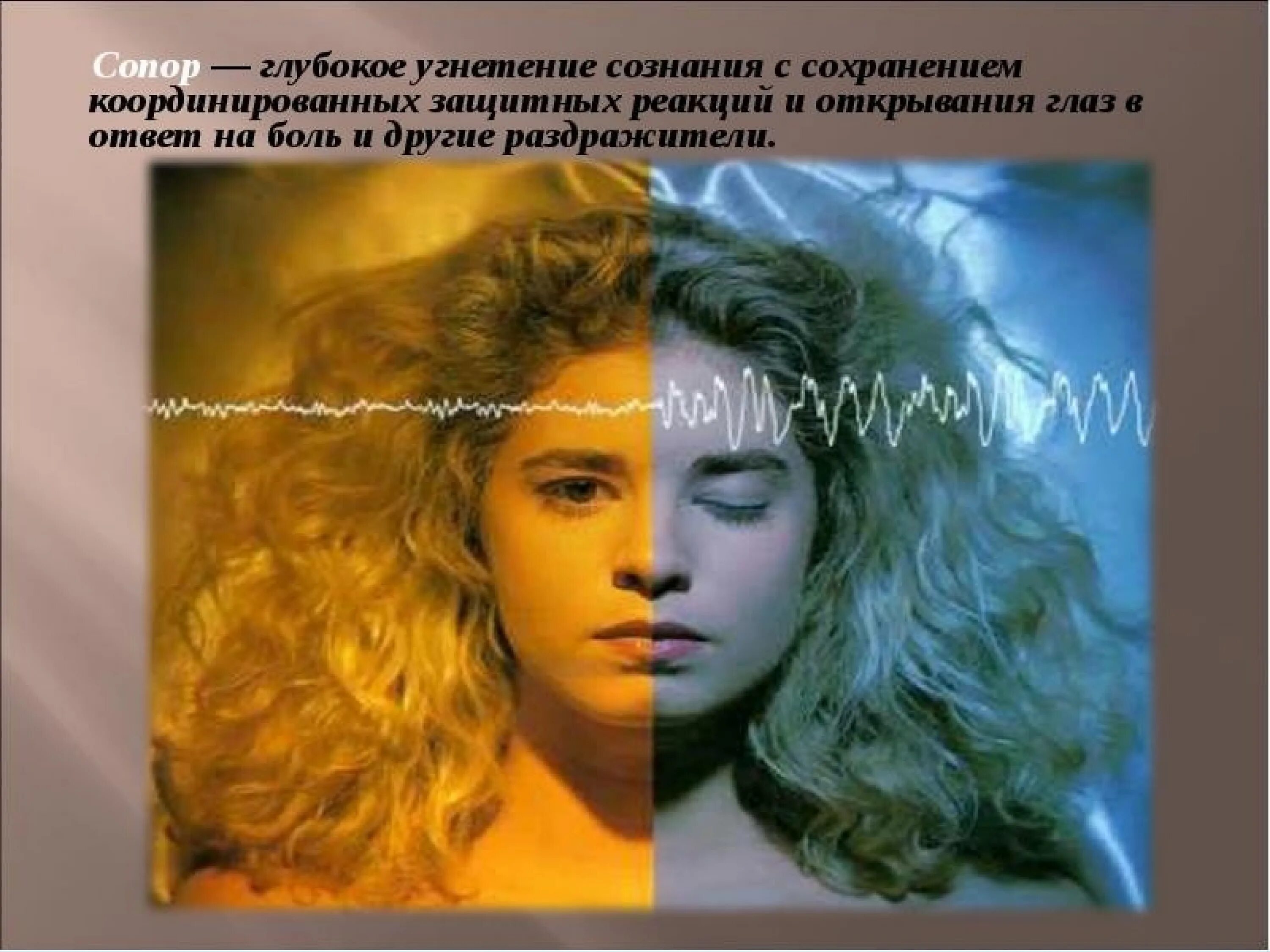 Угнетение сознания. Синдром угнетенного сознания. сон и бодрствование картинки. синдромы выключения сознания.