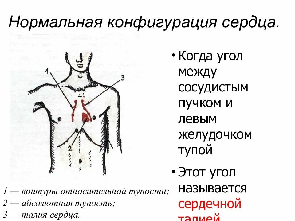 Конфигурации сердца. Поперечник сердца перкуссия. нормальная конфигурация сердца. митральная конфигурация сердца. относительная и абсолютная тупость сердца.