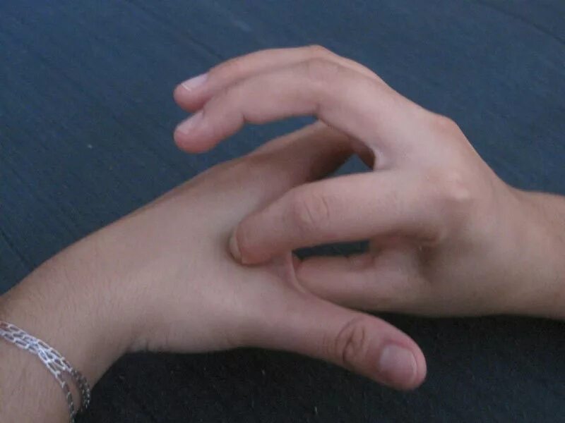 перепонка между большим и указательным пальцем. болит место между большим и указательным пальцем. точечный массаж точки на руках. болит между большим и указательным пальцем. точка между большим и указательным пальцем.