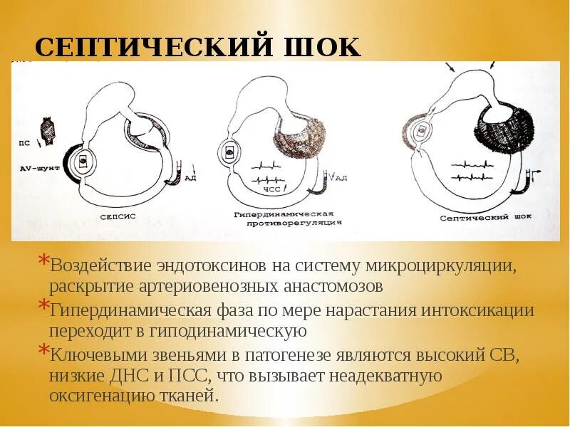 Септический шок тест. Механизм развития септического шока. Гипердинамическая фаза септического шока. Септический ШОК этиология. Фазы развития септического шока.