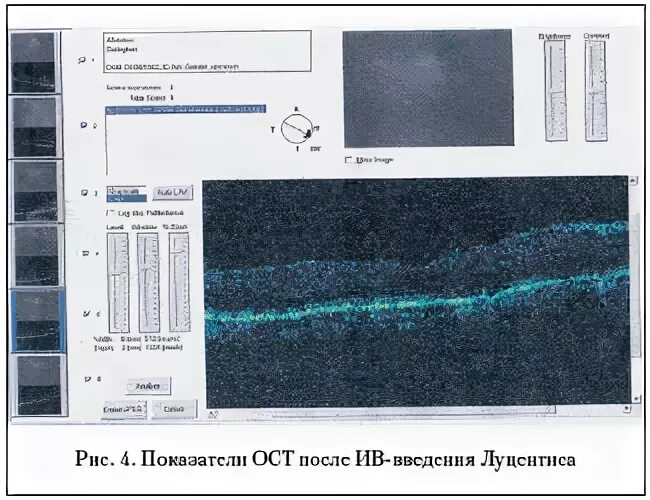 Ост после