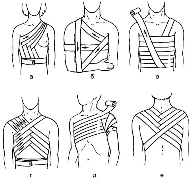 Как перевязать карту. Десмургия перевязки. Десмургия спиральная повязка. Десмургия повязки на грудную клетку. Перелом ребер повязка Дезо.