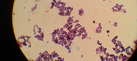 Candida sp