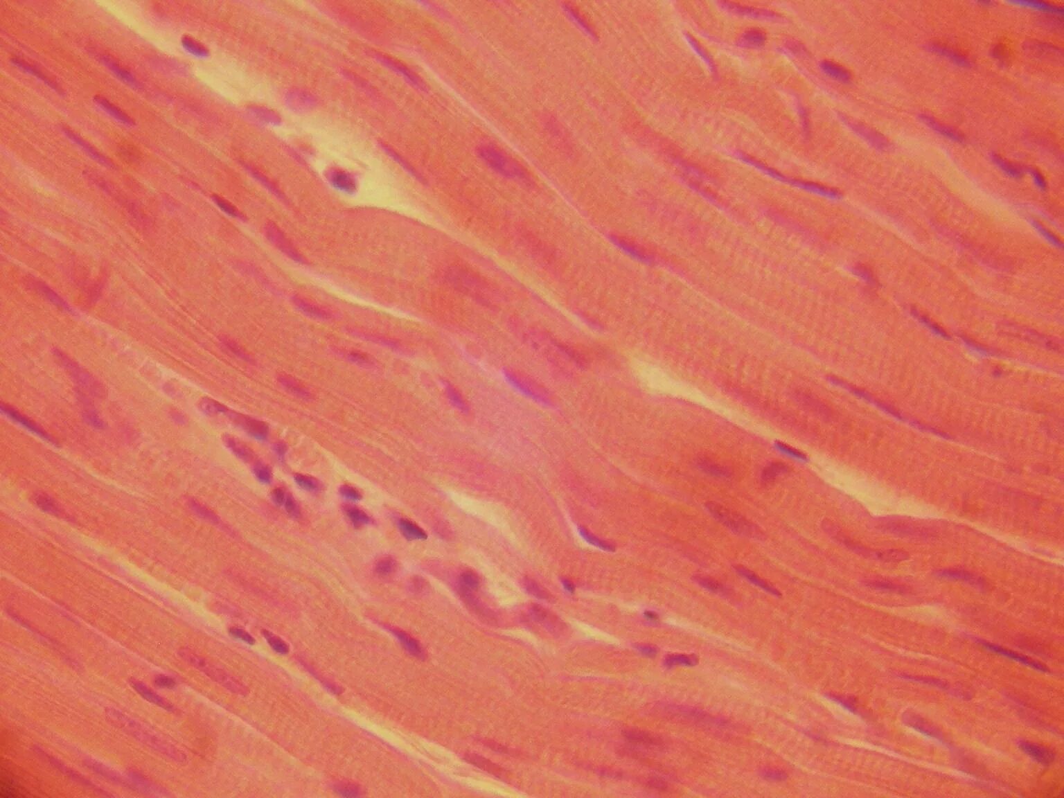 Сердечная мышца представлена тканью. Кардиомиоциты миокарда гистология. Стенка миокарда гистология. Кардиомиоцит гистология миокард. Эндокард гематоксилин - эозин.