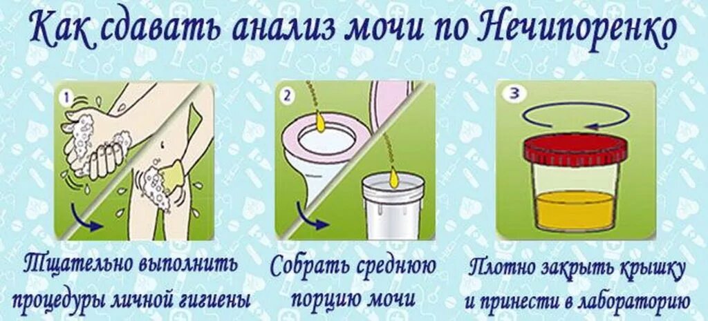 Как нужно сдавать мочу. Для исследования по Нечипоренко мочу собирают. Моча по Нечипоренко алгоритм сбора. Лабораторная посуда для сбора мочи по Нечипоренко. Порция мочи для исследования по Нечипоренко.