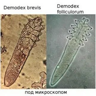 Чем лечить демодекс