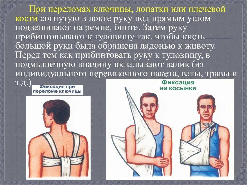 Первая помощь при переломе ключицы. Иммобилизация при переломе ключицы. Оказание первой помощи при переломе ключицы.