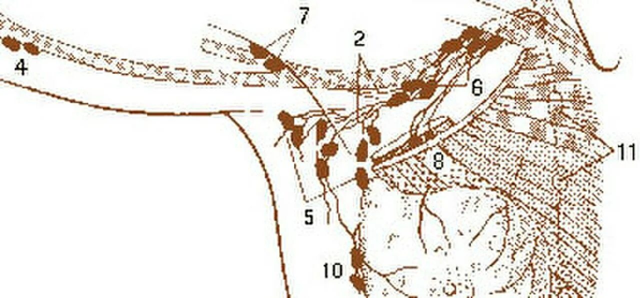 Лимфоузлы под мышками расположение у женщин. Парастернальные лимфоузлы. Подмышечные лимфоузлы схема. Подмышечные лимфоузлы топография. Апикальные подмышечные лимфоузлы.