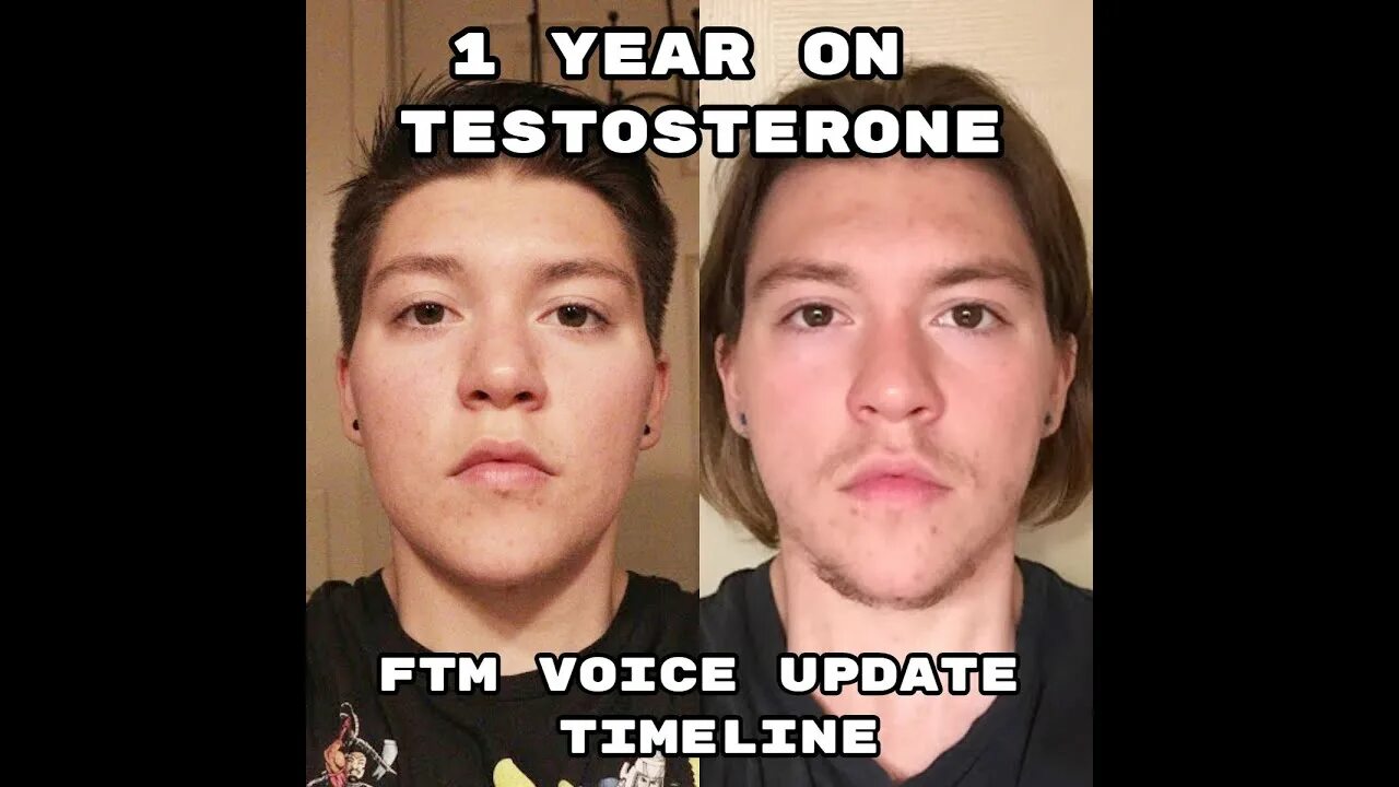 Тестостерон для трансгендеров. Детранзишн ФТМ. Ftm-t558. ФТМ переход.