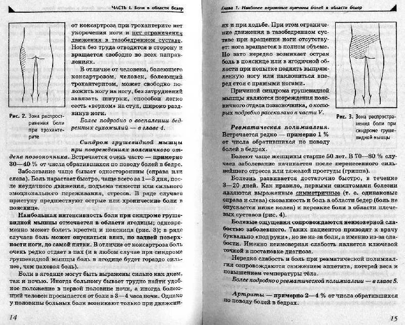 Ноющие боли отдающие в пах. Болит в паховой области у женщины слева. Боль в паху при ходьбе у женщин. Ноющая боль в паховой области у женщин.