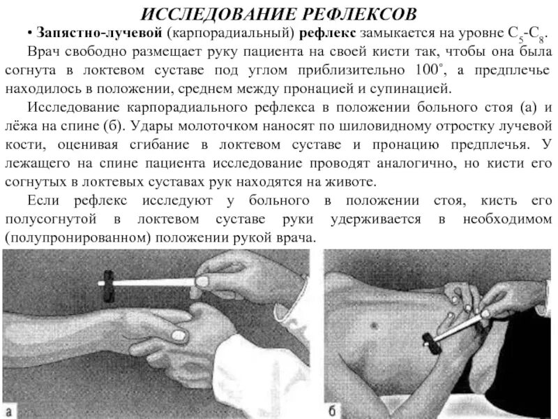 Как проверить рефлексы. Исследование пястно лучевой рефлекс. Карпорадиальный (запястно-лучевой) рефлекс. Исследование карпорадиальный рефлекс. Коркорадиальный рефлек с.