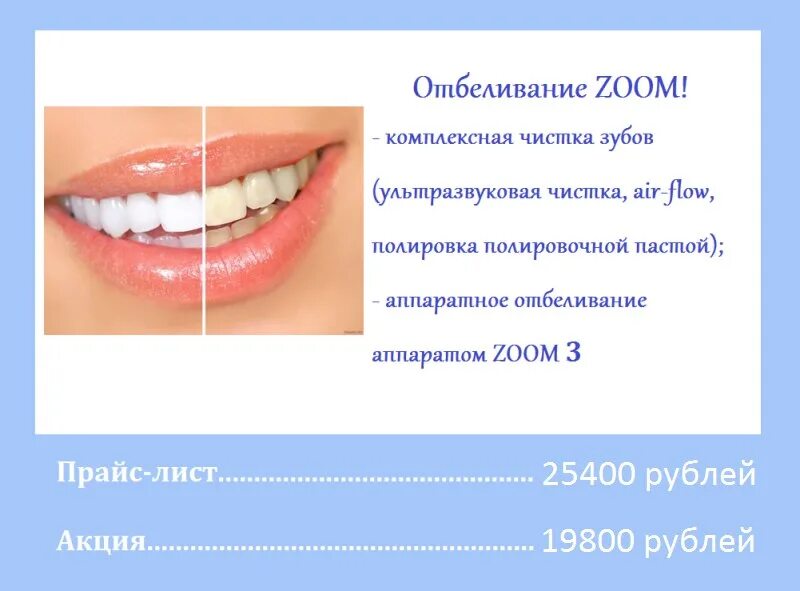 Отбеливание акция. Отбеливание зубов акция. Буклет отбеливание зубов. Отбеливание зубов строгино