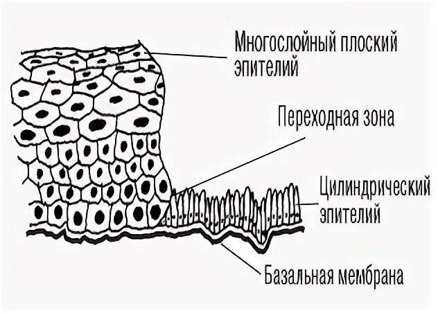 Мпэ 1 орг