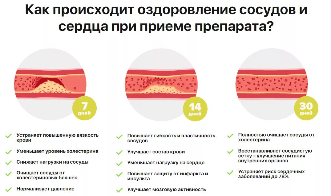 Сосуды оздоровление. Омега 3 и сосуды влияние. Средства для эластичности сосудов. Еда для эластичности сосудов.