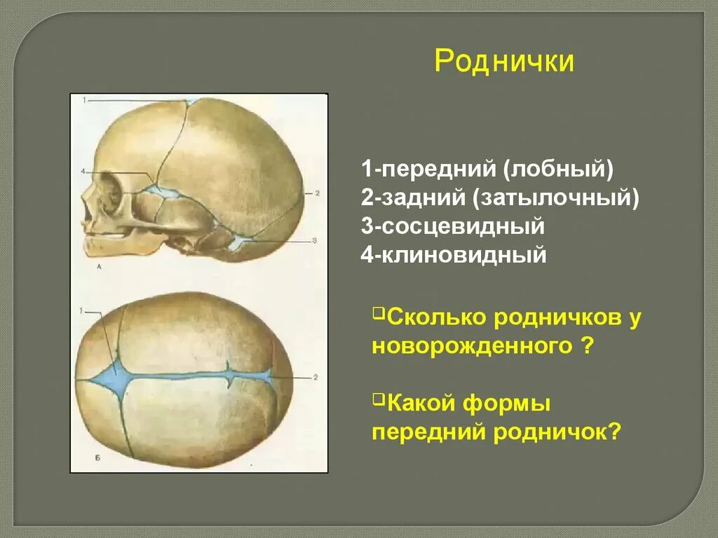 Передний родничок. Скелет головы швы черепа роднички. Роднички черепа анатомия. Швы и роднички черепа анатомия. Роднички новорожденного анатомия черепа.