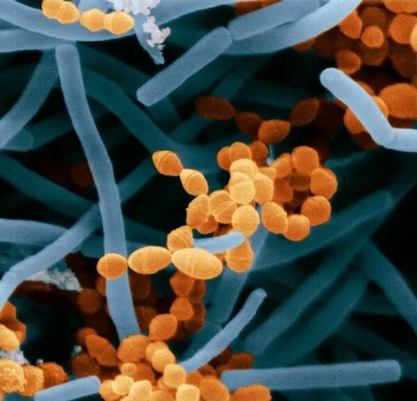 Болгарская палочка мечников. Болгарская палочка lactobacillus bulgaricus. Термофильный молочнокислый стрептококк и болгарская палочка. Молочнокислые стрептококки под микроскопом. Термофильный стрептококк под микроскопом.