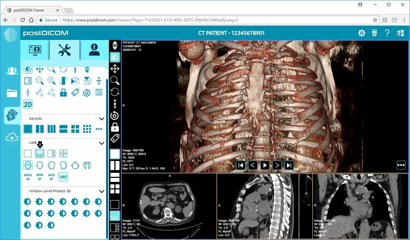Программа для просмотра кт и мрт. Dicom мрт снимки. dicom мрт программа для просмотра. dicom файлы мрт. dicom формат.