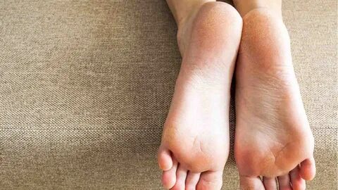 Hard foot