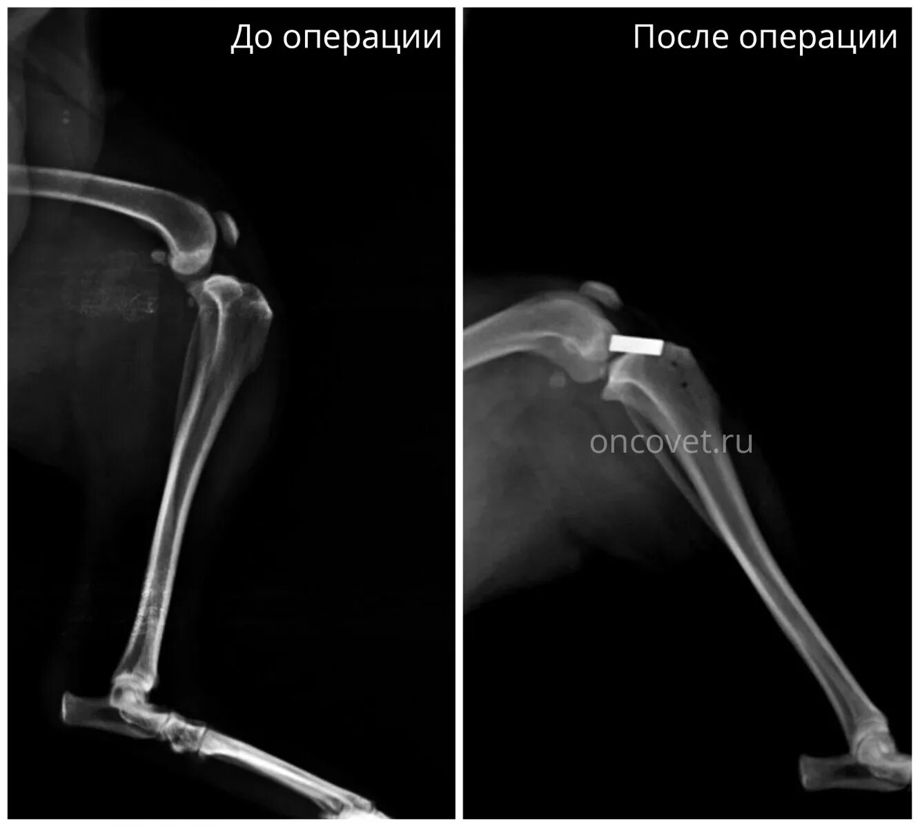 Разрыв связки у собаки. Разрыв крестообразных связок рентген. Разрыв ПКС У собаки рентген. Разрыв передней крестообразной связки у собаки рентген. Разрыв передней крестообразной связки у собаки.