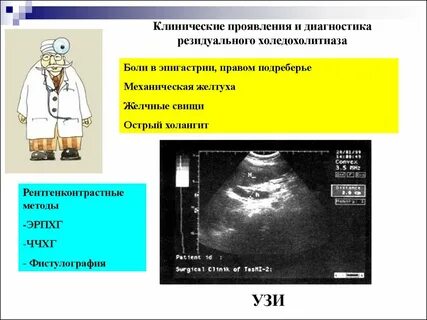 Холедохолитиаз рекомендации