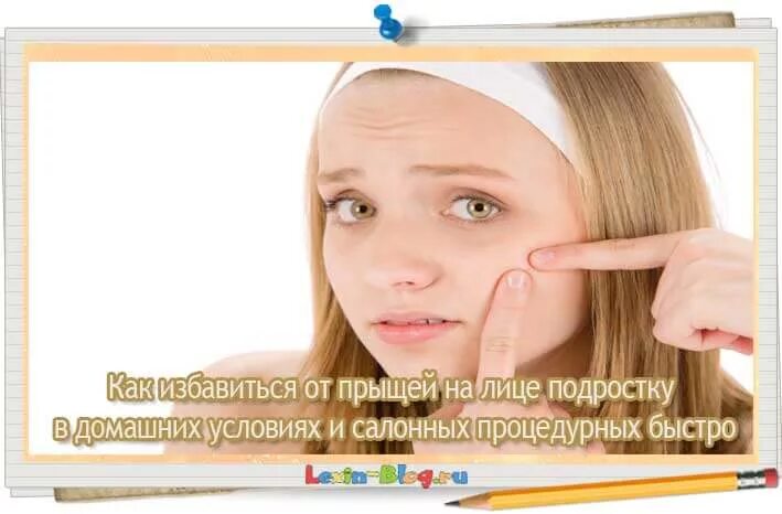 Как избавиться от прыщей на лице быстро. Как избавиться от прыщей в домашних условиях быстро за 1 день. как избавиться от прыщей в домашних условиях за 1 день в 12 лет. как избавиться от прыщей на лице за 1 день девочке. как избавиться от прыщей на лице быстро девушке.