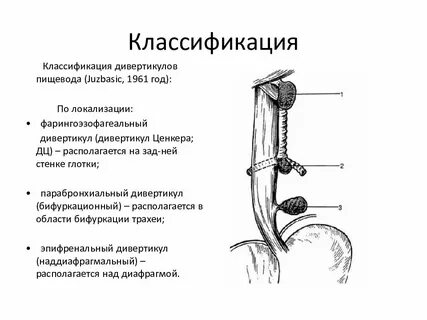 Непроходимость пищевода