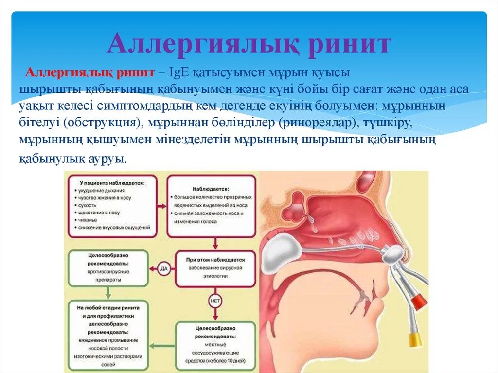 Что такое хронический ринит