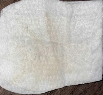Водянистые выделения на раннем сроке
