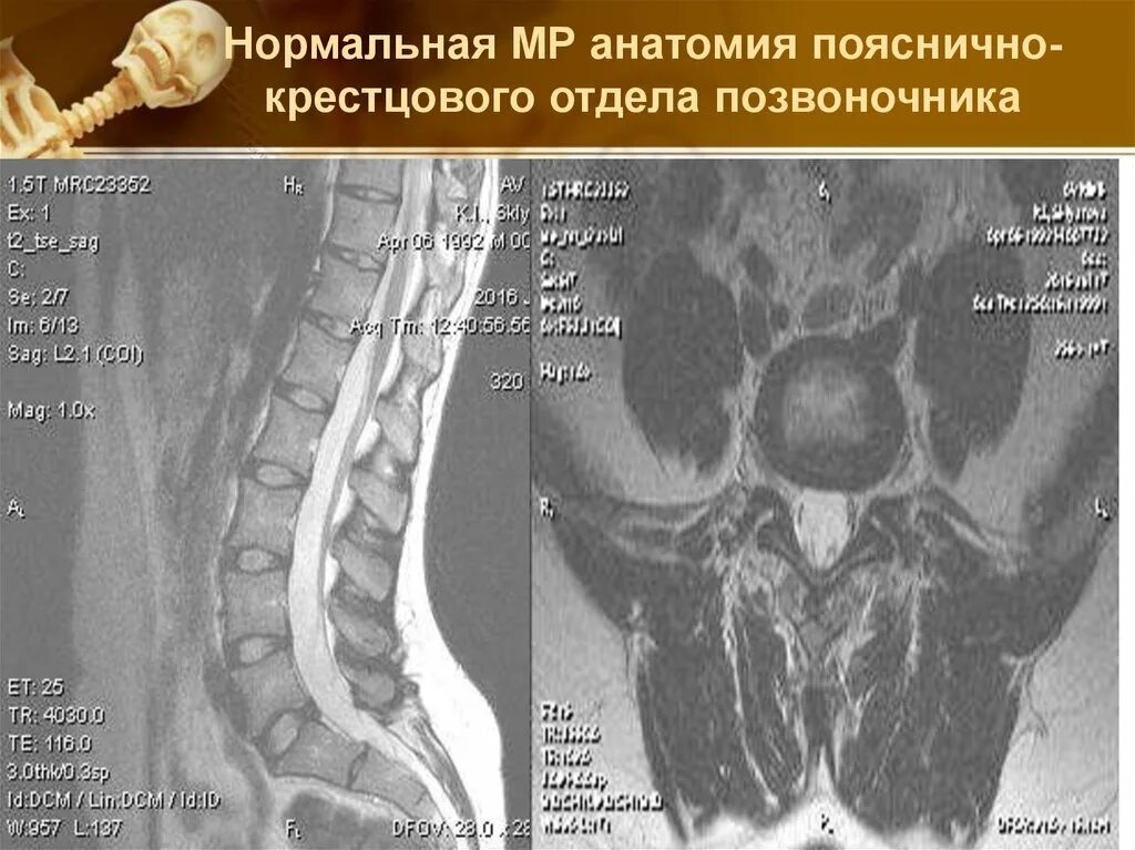 Мрт анатомия поясничного отдела позвоночника. Пояснично-крестцовый отдел позв. Позвонки крестцового отдела. Крестово поясничный отдел позвоночника. Органы крестцового отдела