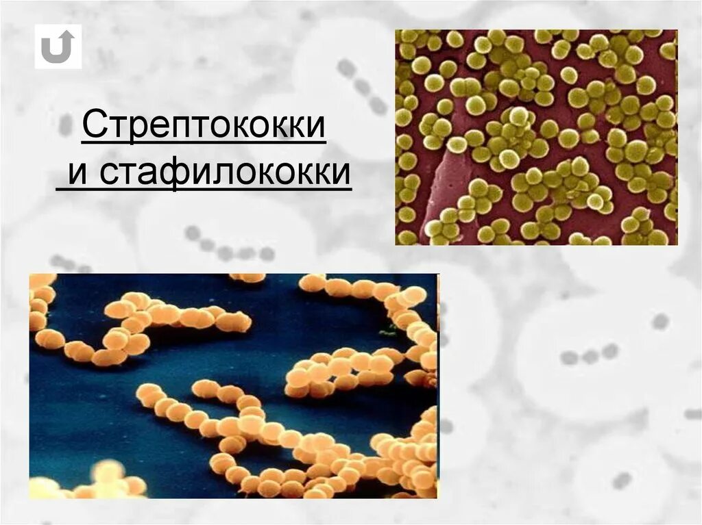 3-Стрептококки стафилококки. Стафилококки и стрептококки микробиология. Стафилококки стрептококки кишечная палочка. * Стафилококки * стрептококки * кишечная палочка * синегнойная палочка.