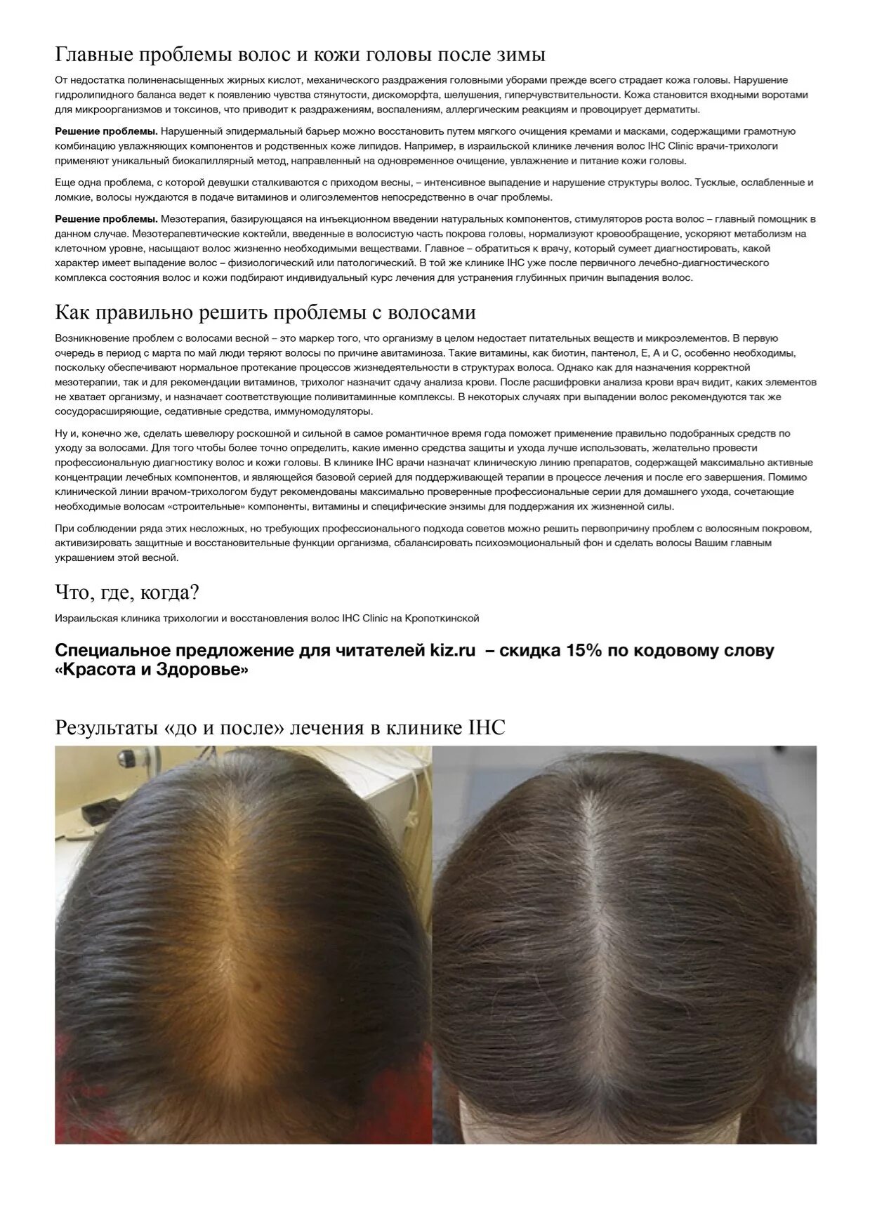 Анализы при выпадении волос. Трихология выпадение волос. Рекомендация при выпадении волос. Причины сильного выпадения волос.