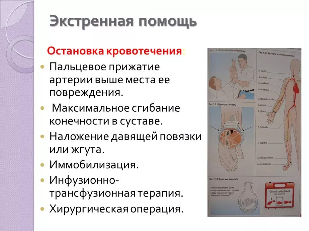 Экстренная помощь при кровотечениях. Неотложная помощь при острой кровопотере. Неотложная помощь при кровотечениях. Экстренная помощь при кровотечении. Остановка кровотечения неотложная помощь.