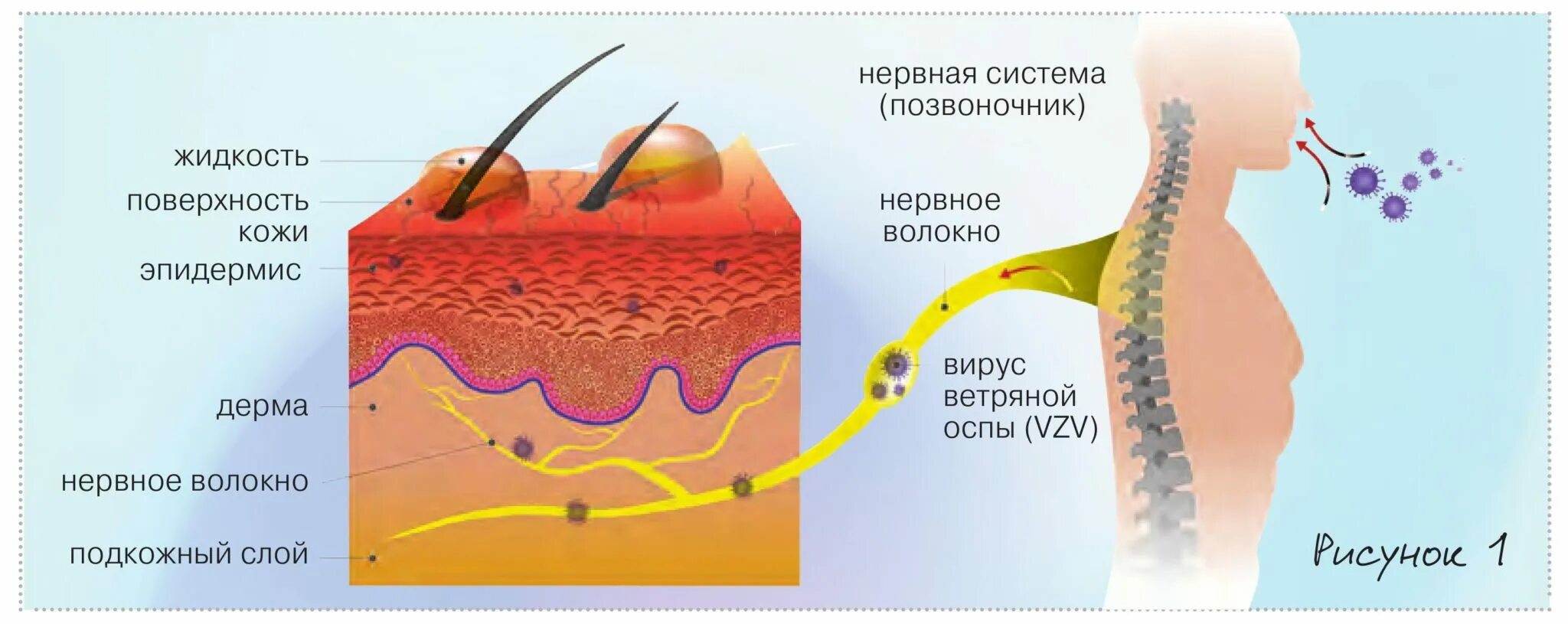Как долго лечится опоясывающий. Локализация опоясывающего герпеса. герпес опоясывающий лишай.
