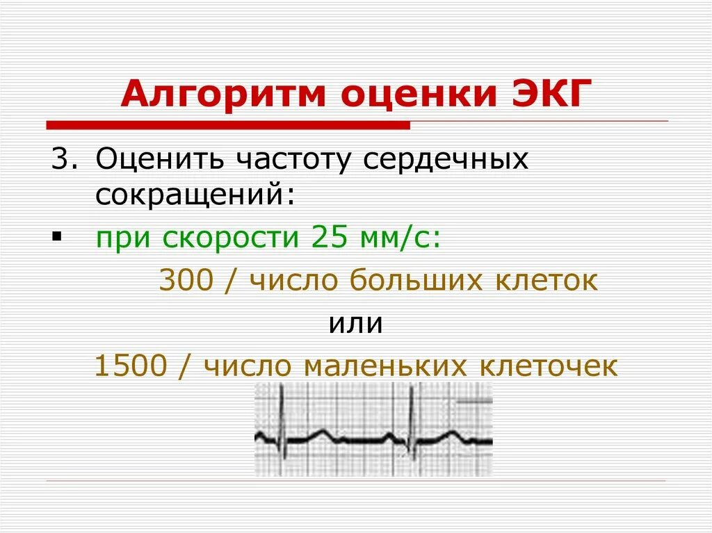 Как измерить частоту сердечных. ЧСС на ЭКГ 25 мм/с. Подсчёт ЧСС по ЭКГ 25 мм. Подсчет ЧСС на ЭКГ 50 мм/с. Частота сердечных сокращений по ЭКГ формула.