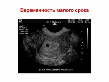 Дата меньше минимальной