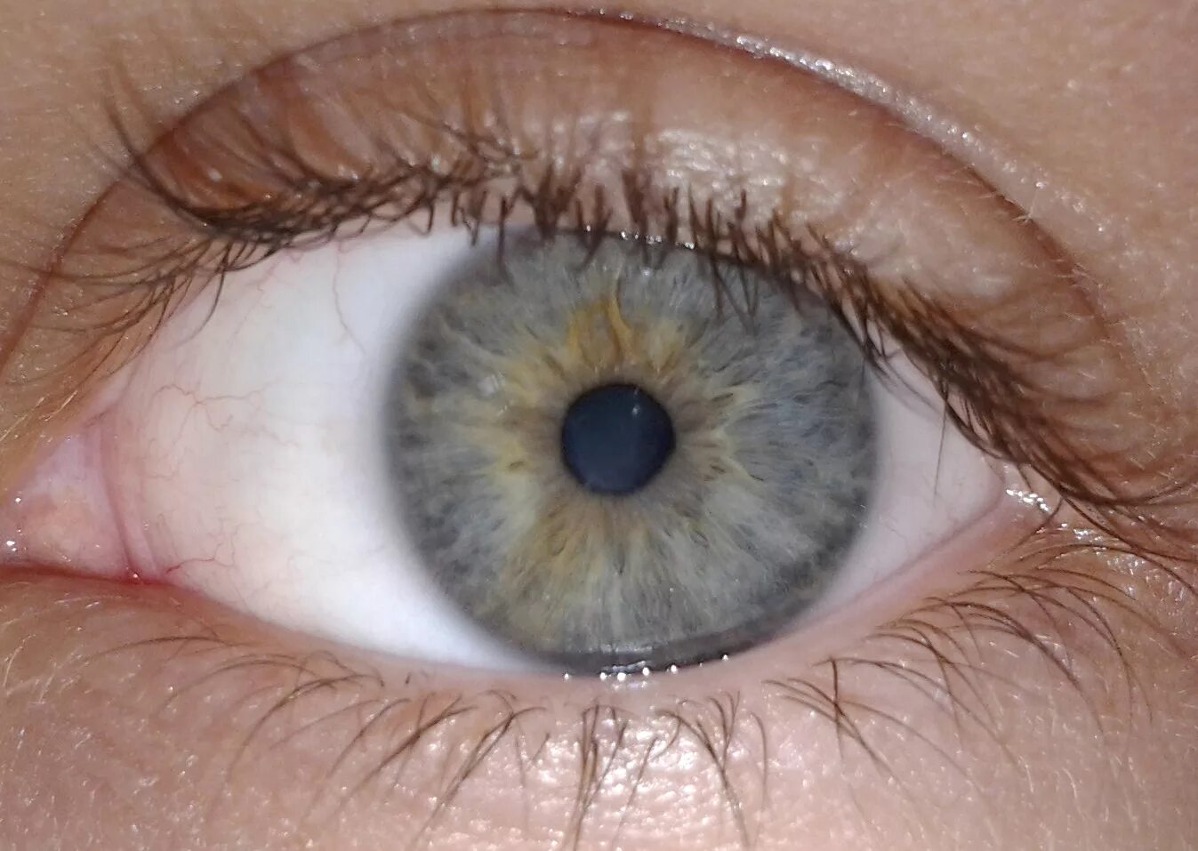 Серая радужка. Центральная гетерохромия Радужки глаз. Ободок вокруг зрачка. Желтый ободок вокруг зрачка. Голубо коричневые глаза.