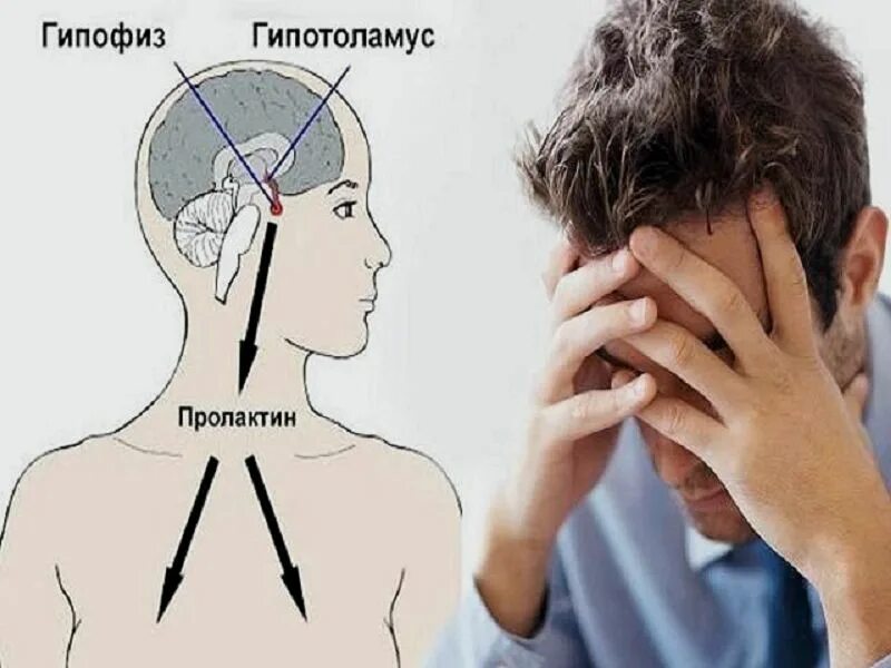 Что такое пролактин. Пролактин. пролактин картинка. повышенный пролактин у мужчин. пролактин это мужской.