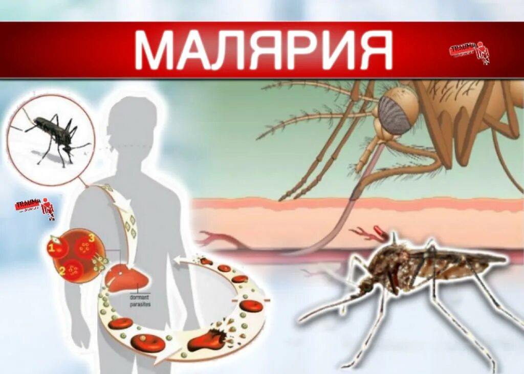 Заражение человека малярией происходит. Я маляр. Малярия профилактика заболевания.