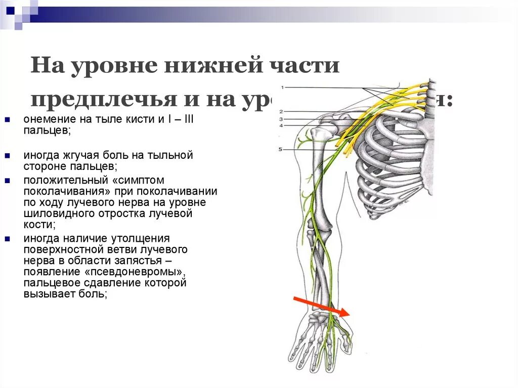 Уровни компрессии лучевого нерва. Лучевой срединный и локтевой нерв. Ветви лучевого нерва на предплечье. Уровни поражения лучевого нерва.