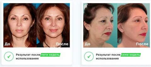 Лицо овал отзывы