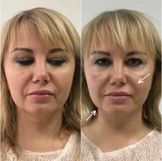 Смас глаза отзывы